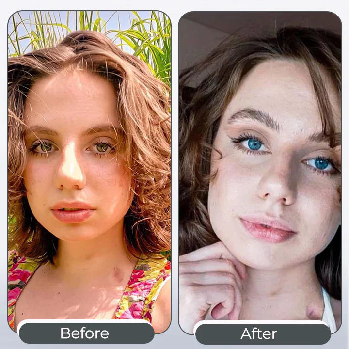 ✨Tiworld™ 𝑺𝒑𝒆𝒄𝒕𝒓𝒂𝑬𝒚𝒆 𝑪𝒐𝒍𝒐𝒓 𝑪𝒉𝒂𝒏𝒈𝒊𝒏𝒈 𝑫𝒓𝒐𝒑𝒔 𝑷𝒓𝒐 – Made in the USA & FDA-Certified